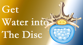 Back And Neck Care Center uses spinal manipulation and exercise to enhance the diffusion of water into the disc which supports the health of the disc.