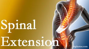 Back And Neck Care Center understands the role of extension in spinal motion, its necessity, its benefits and potential harmful effects. 