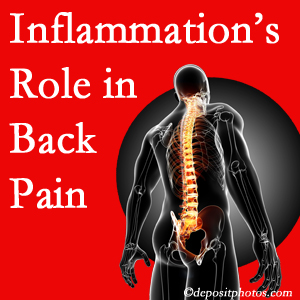 The role of inflammation in Severna Park back pain is real. Chiropractic care can help.