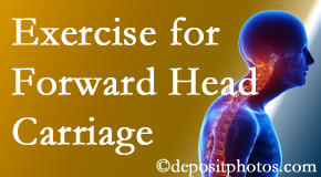 Severna Park chiropractic treatment of forward head carriage is two-fold: manipulation and exercise.