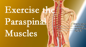 Back And Neck Care Center describes the importance of paraspinal muscles and their strength for Severna Park back pain relief.