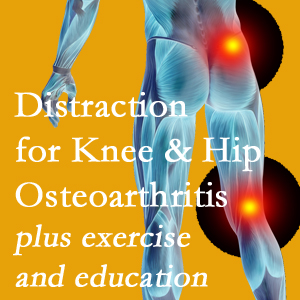 A chiropractic treatment plan for Severna Park knee pain and hip pain caused by osteoarthritis: education, exercise, distraction.