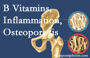 Severna Park chiropractic care of osteoporosis often comes with nutritional tips like b vitamins for inflammation reduction and for prevention.