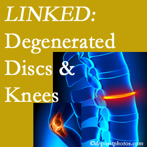 Degenerated discs and degenerated knees are not such unlikely companions. They are seen to be related. Severna Park patients with a loss of disc height due to disc degeneration often also have knee pain related to degeneration.  