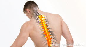 Severna Park thoracic spine pain image 