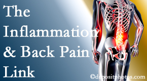 Back And Neck Care Center addresses the inflammatory process that accompanies back pain as well as the pain itself.