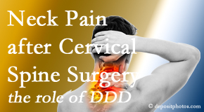 Back And Neck Care Center offers gentle care for neck pain after neck surgery.