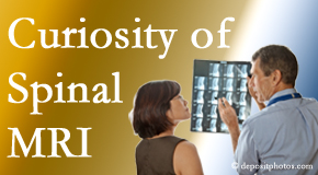 Severna Park MRIs for spinal stenosis may be revealing…or confusing.