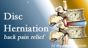 Back And Neck Care Center uses non-surgical treatment for relief of disc herniation related back pain. 