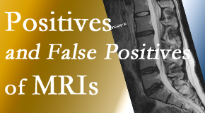 Back And Neck Care Center carefully chooses when and if MRI images are needed to guide the Severna Park chiropractic treatment plan. 